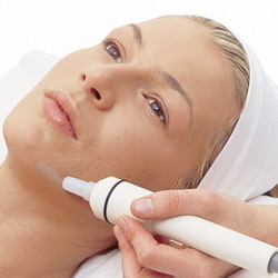 microdermabrasion