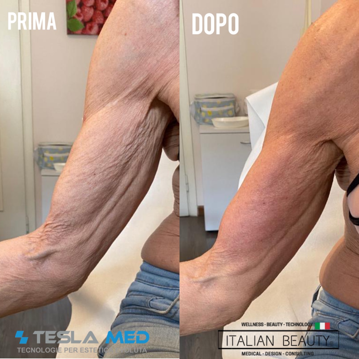 tesla med
